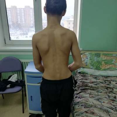В ДРКБ успешно проведена операция по протезированию межпозвоночного диска 14-летнему мальчику, поступившему по «скорой помощи» в приемный покой больницы из сельского района республики